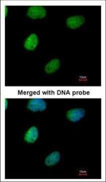 ITPK1 Rabbit Polyclonal Antibody