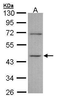 ITPK1 Rabbit Polyclonal Antibody