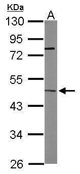 ITPK1 Rabbit Polyclonal Antibody