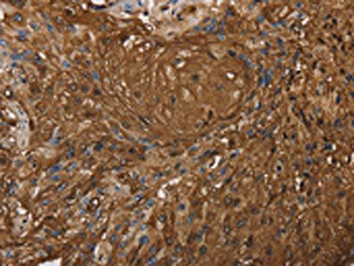 ITPR3 Antibody