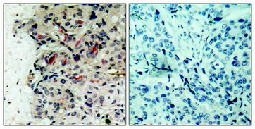 JAK1 Antibody