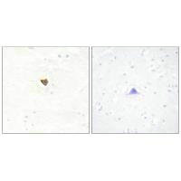 JAKMIP2 Antibody