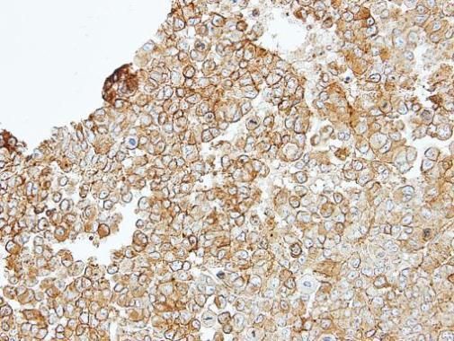 JAM-B Rabbit Polyclonal Antibody