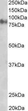 Plakoglobin/Gamma-catenin Antibody