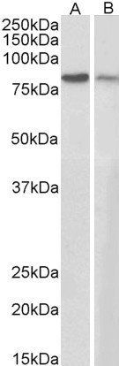 Plakoglobin/Gamma-catenin Antibody