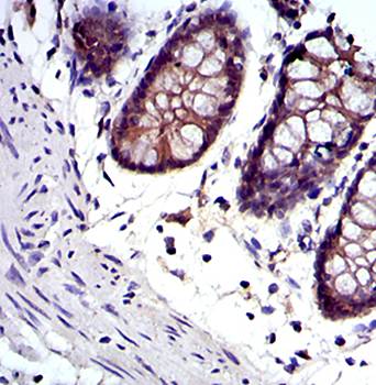 JUP Antibody