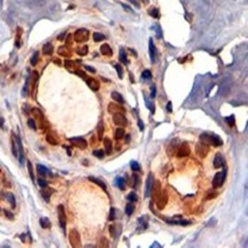 KAP1/TRIM28 Antibody