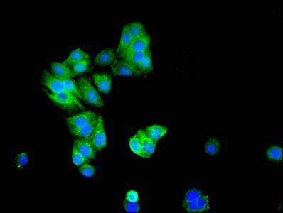 KCNIP3 Antibody