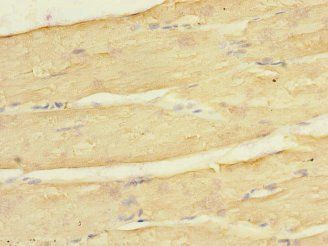KCNJ4 Antibody