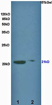 KCNMB1 Rabbit pAb