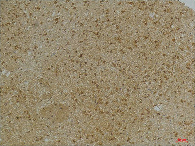 KCNN2 Antibody