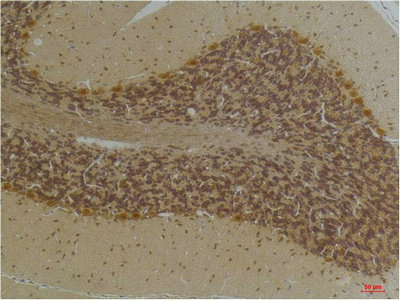 KCNN2 Antibody