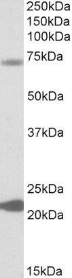 KCNN2 Antibody