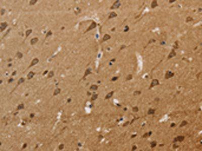 KCNN4 Antibody