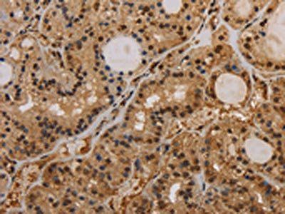 KCNN4 Antibody