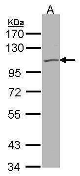 HSPA6 Rabbit Polyclonal Antibody