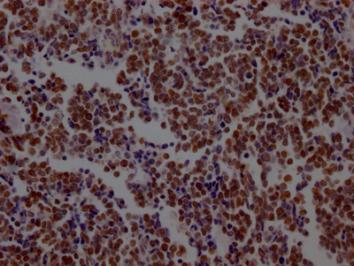 KDM1A Antibody