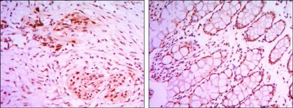 KDM4A Antibody