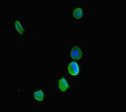 KDM5C Antibody