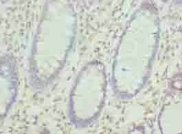 KHDRBS2 Antibody