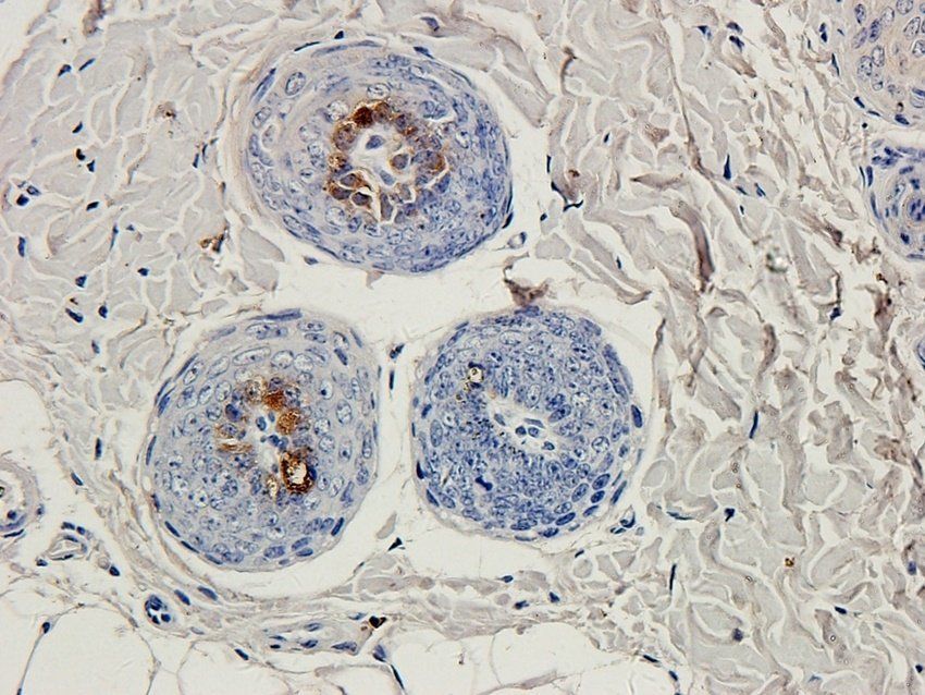 Ki67 Rabbit Polyclonal Antibody