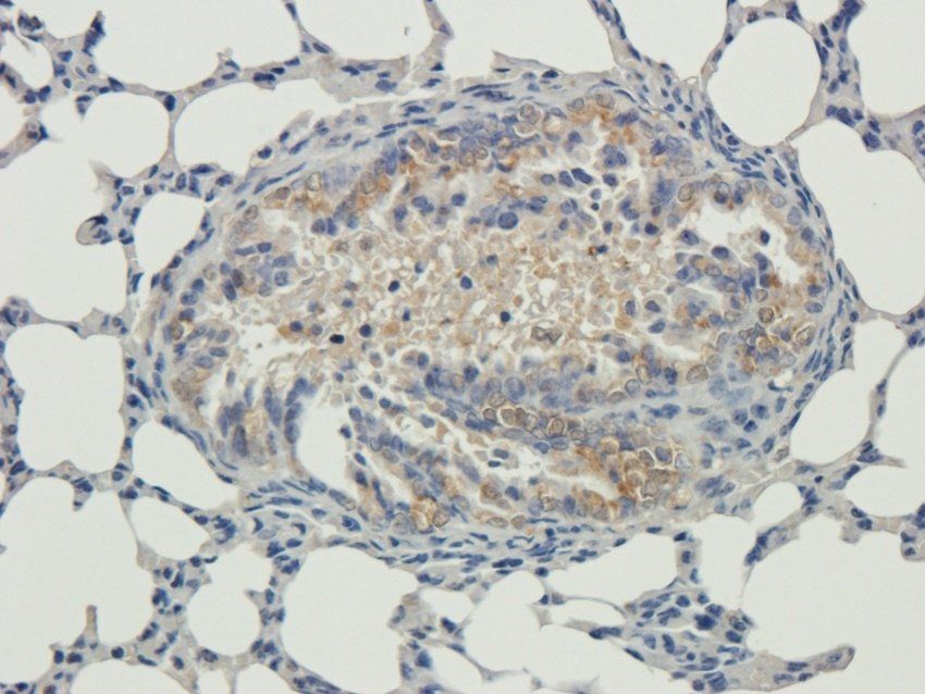 Ki67 Rabbit Polyclonal Antibody