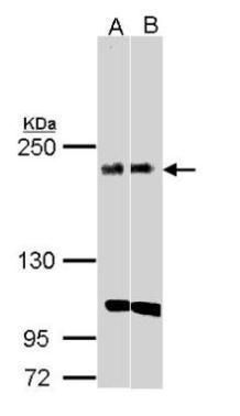 KIDINS220 Rabbit Polyclonal Antibody