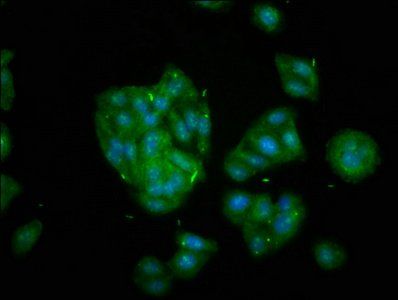 KIF20B Antibody
