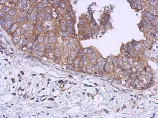 KIF5B Rabbit Polyclonal Antibody