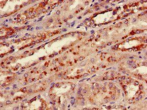 KNG1 Antibody (Biotin)