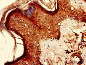 KIR2DS2 Antibody