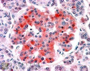Kcnj11/Kir6.2 Antibody