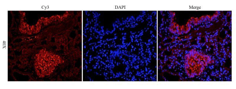 KLF2 Rabbit Polyclonal Antibody