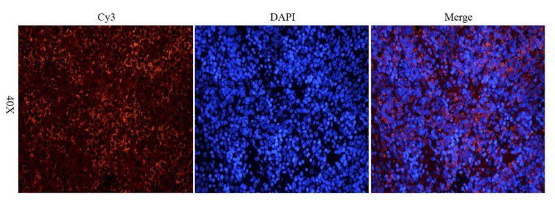 KLF2 Rabbit Polyclonal Antibody