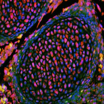 KLF2 Rabbit Polyclonal Antibody