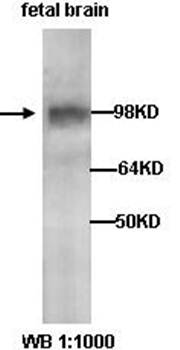 KLHL1 Rabbit Polyclonal Antibody