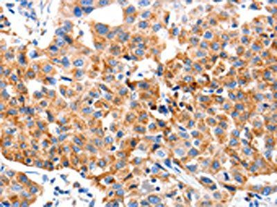 KLK2 Antibody
