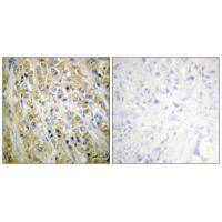 KLK3 Antibody