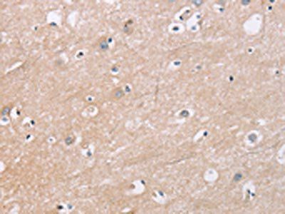 KLK4 Antibody
