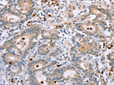 KLK4 Antibody