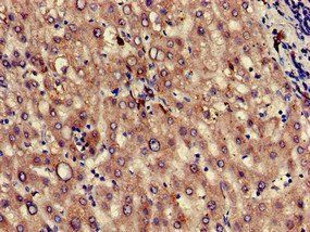 KLKB1 Antibody