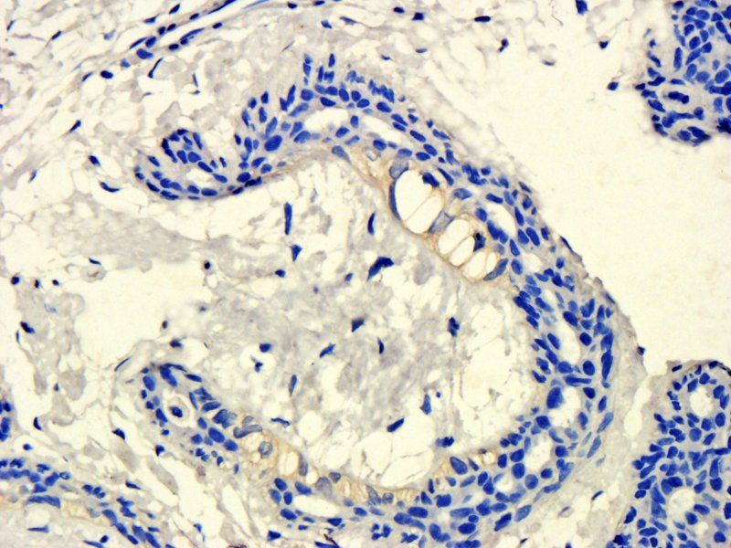 KLKB1 Rabbit Polyclonal Antibody