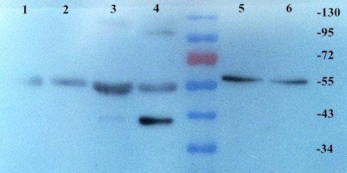 KLKB1 Rabbit Polyclonal Antibody