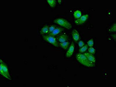 KLRD1 Antibody