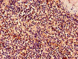 KLRK1 Antibody