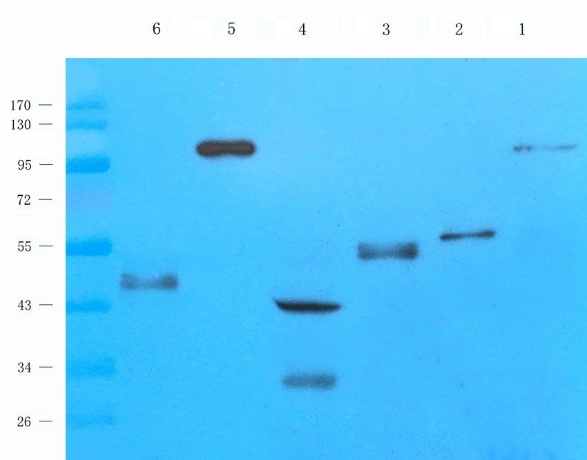 KPNA2 Rabbit Polyclonal Antibody