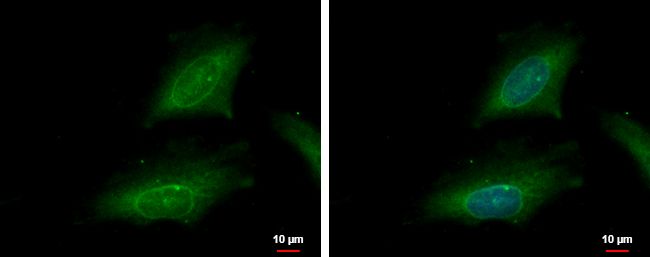 KPNA2 Rabbit Polyclonal Antibody
