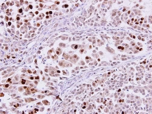 KPNA2 Rabbit Polyclonal Antibody
