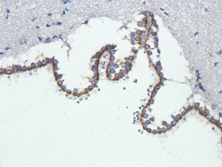Krox-20 Rabbit Polyclonal Antibody