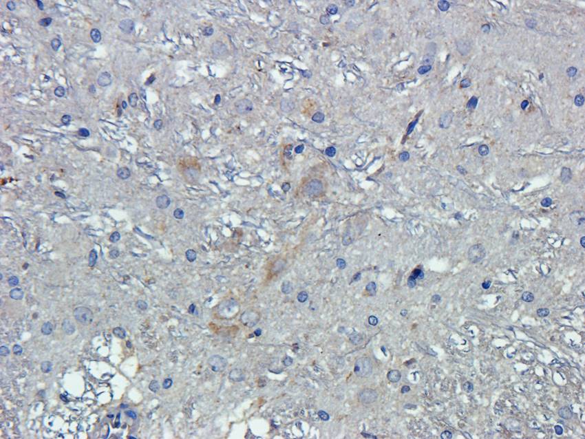 Krox-20 Rabbit Polyclonal Antibody